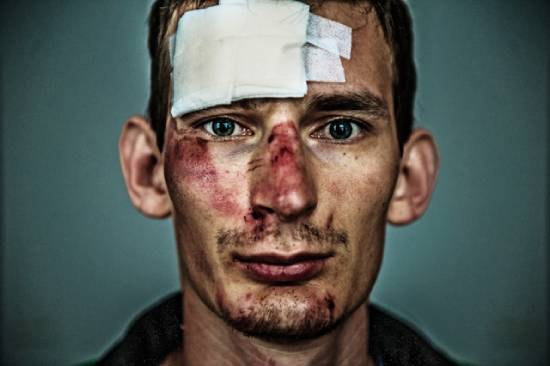 A man with scrapes, bruises, and a bandage on his face. This gives us an idea of what the man in the parable experienced when he was attacked on the road to Jericho.