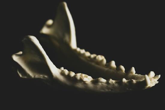 Jaw bone Jaw bone as we study how Samson, a judge of Israel and from the tribe of Dan, used Donkey's jawbone to kill 1,000 philistines